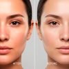 After before despigmentacion piel tratamiento profesional peel off mascarilla vitamina c After before despigmentacion piel tratamiento profesional peel off mascarilla vitamina c