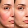 Serum Facial antirojeces hidratacion profunda uso domestico algas marinas colageno Serum Facial antirojeces hidratacion profunda uso domestico algas marinas colageno